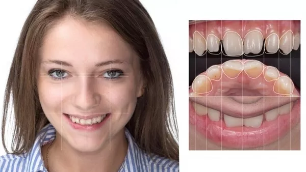 Лечение ,  протезирование и имплантация зубов в Полтаве на выгодных усл 3